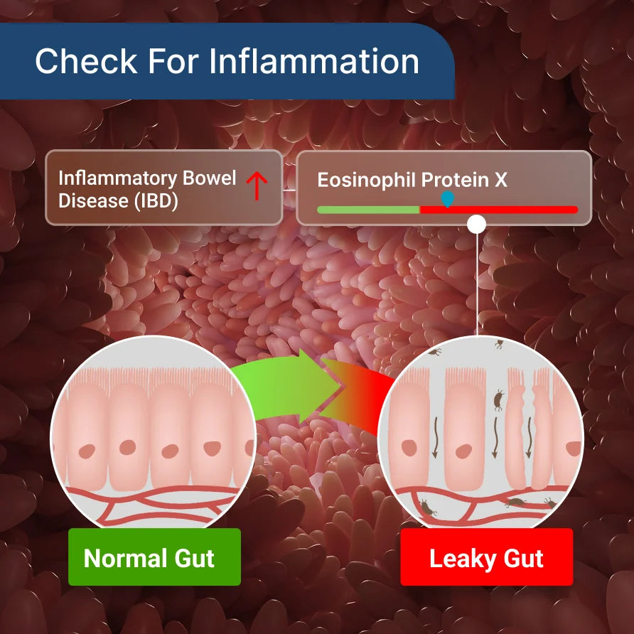 Gut Health Test